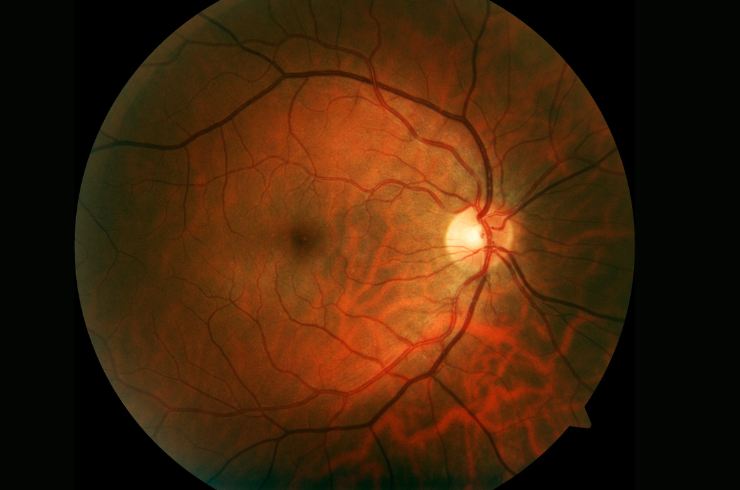 ESWAR EYE HOSPITAL