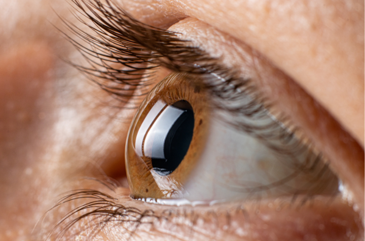 ESWAR EYE HOSPITAL